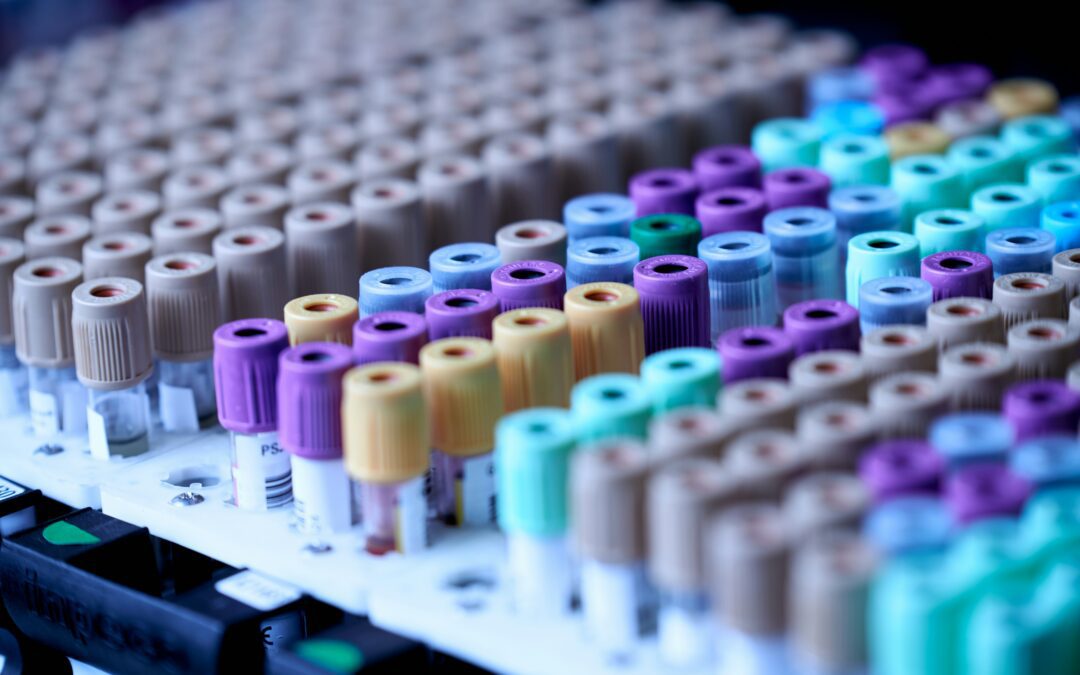 The Role of Drug Testing in Recovery